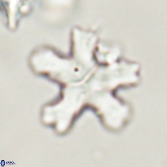 Discoaster anisogonius VR 32164