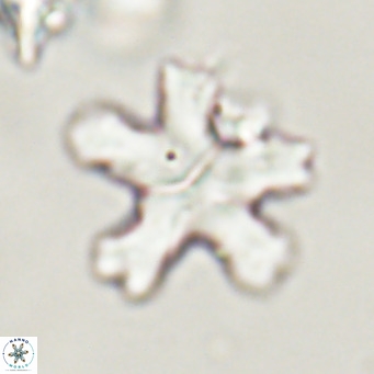 Discoaster anisogonius VR 32164