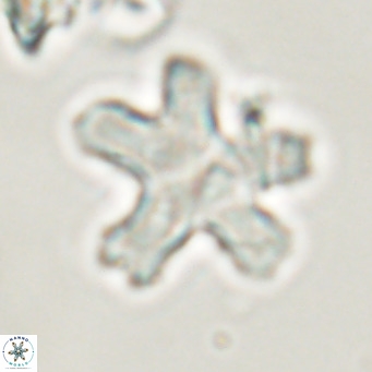 Discoaster anisogonius VR 32165