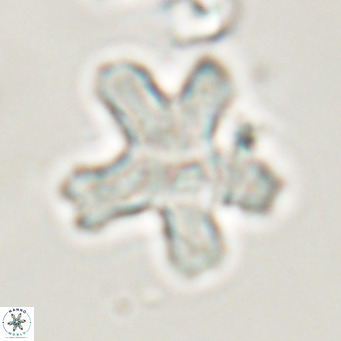 Discoaster anisogonius VR 32167
