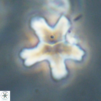 Discoaster anisogonius VR 32168