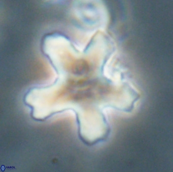 Discoaster anisogonius VR 32169