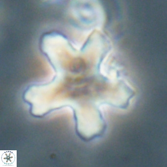 Discoaster anisogonius VR 32169