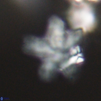 Discoaster anisogonius VR 32174