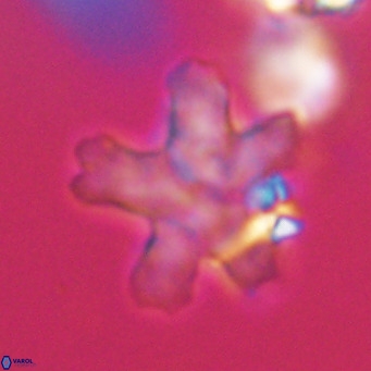 Discoaster anisogonius VR 32175