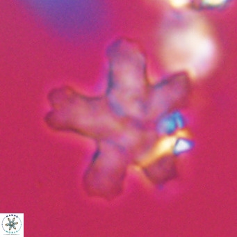 Discoaster anisogonius VR 32175