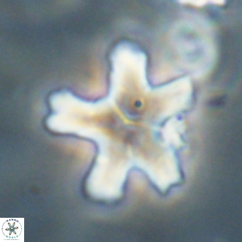 Discoaster anisogonius VR 32170