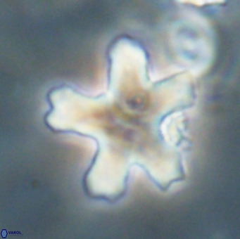 Discoaster anisogonius VR 32171