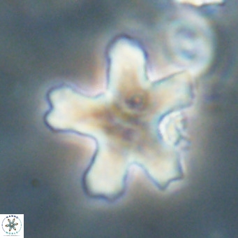 Discoaster anisogonius VR 32171