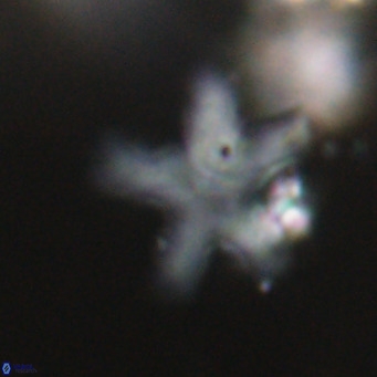 Discoaster anisogonius VR 32173