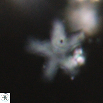 Discoaster anisogonius VR 32173