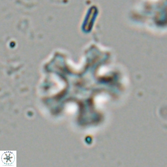 Discoaster anisogonius 27679