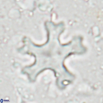 Discoaster anisogonius 27870