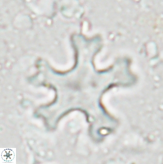 Discoaster anisogonius 27870