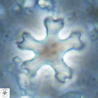 Discoaster anisogonius 27871