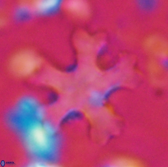 Discoaster anisogonius 27872