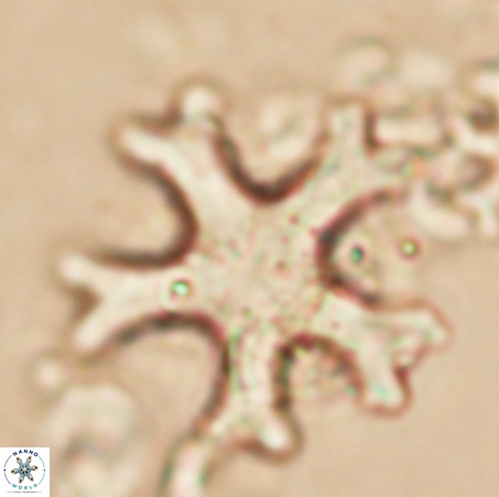 Discoaster anisogonius 365