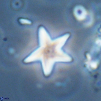 Discoaster anisopentactis 70754