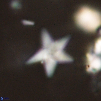 Discoaster anisopentactis 70755
