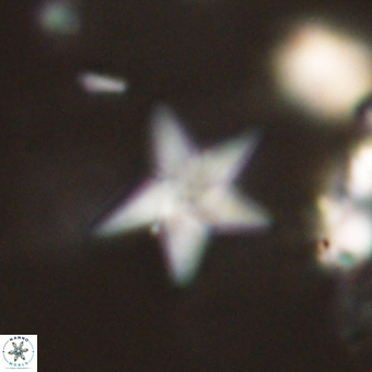 Discoaster anisopentactis 70755
