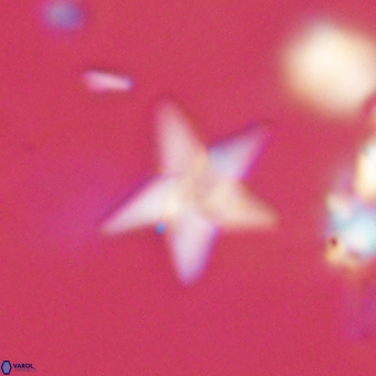 Discoaster anisopentactis 70756