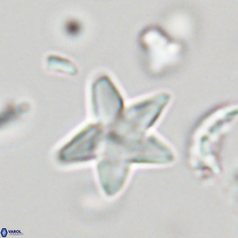 Discoaster anisopentactis 70751
