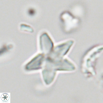 Discoaster anisopentactis 70751