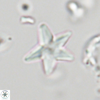 Discoaster anisopentactis 70752