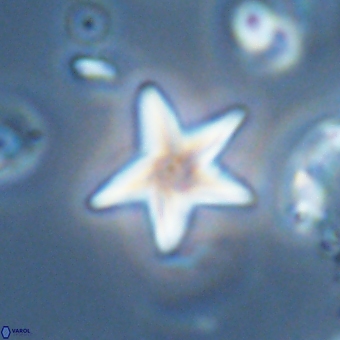 Discoaster anisopentactis 70753
