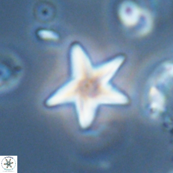 Discoaster anisopentactis 70753