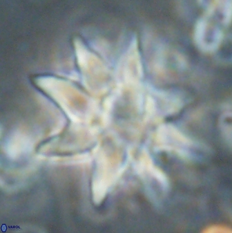 Discoaster araneus 58698