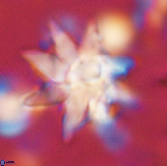 Discoaster araneus 58700