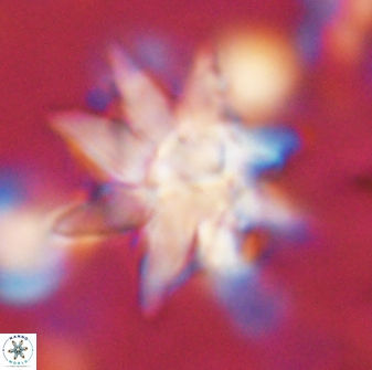Discoaster araneus 58700