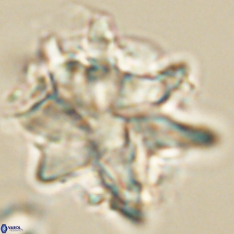 Discoaster araneus 67723