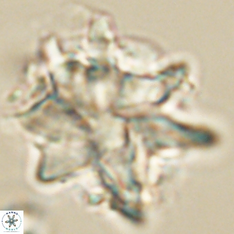 Discoaster araneus 67723
