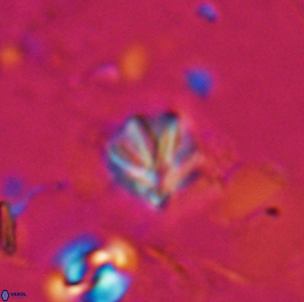 Discoaster artatus 27188