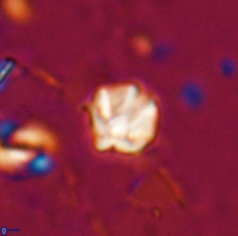 Discoaster artatus 27196