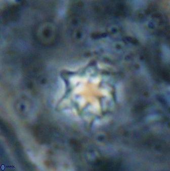 Discoaster artatus 27207