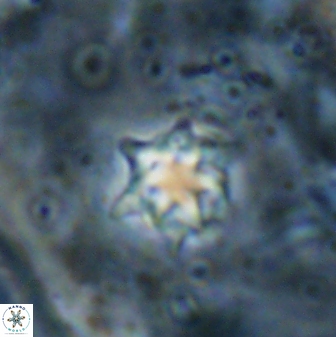 Discoaster artatus 27207