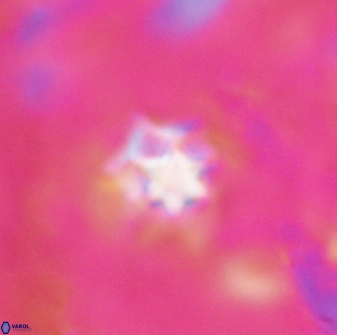 Discoaster artatus 27208