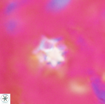 Discoaster artatus 27208