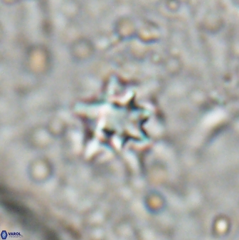 Discoaster artatus 27214