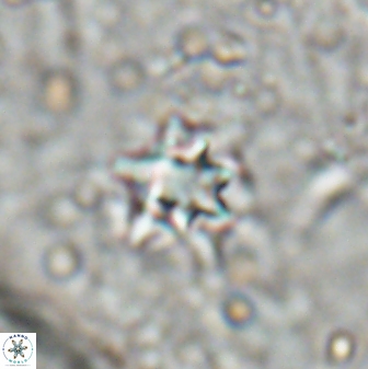 Discoaster artatus 27214