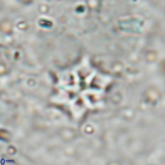 Discoaster artatus 27243