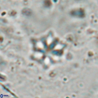 Discoaster artatus 27245