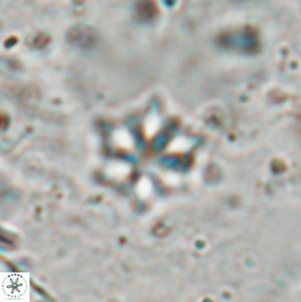 Discoaster artatus 27245