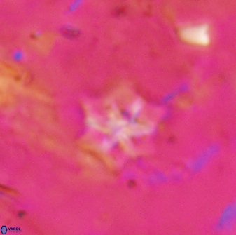 Discoaster artatus 27249