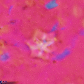 Discoaster artatus 27250