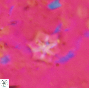 Discoaster artatus 27250