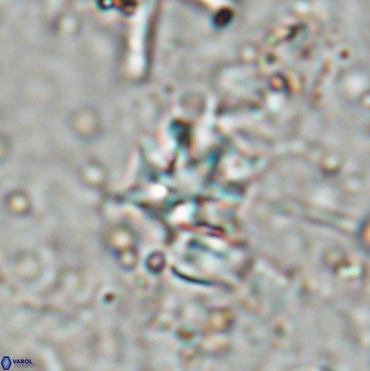 Discoaster artatus 27280